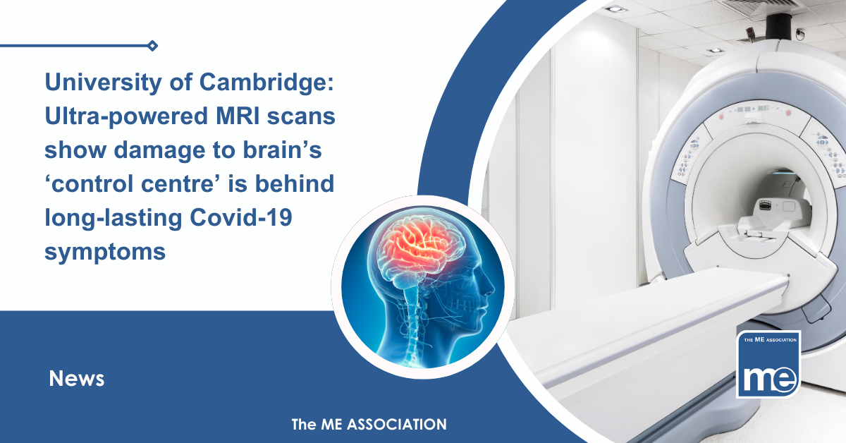 IMAGE DESCRIPTION: An image of a MRI scanner and a circular image of a an outline of the human head and brain showing. Title: University of Cambridge: Ultra-powered MRI scans show damage to brain’s ‘control centre’ is behind long-lasting Covid-19 symptoms. The ME Association Logo (bottom right).
