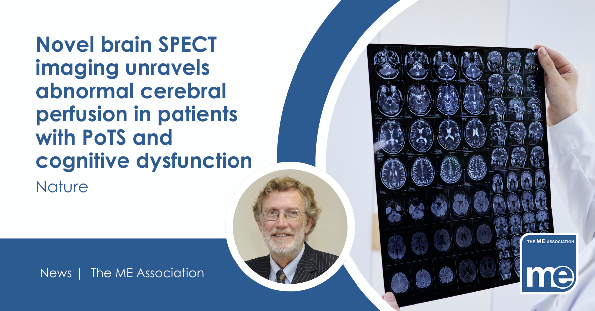 IMAGE DESCRIPTION. Image of a brain scan. Image of Dr Charles Shepherd. Wording - Novel brain SPECT imaging unravels abnormal cerebral perfusion in patients with PoTS and cognitive dysfunction