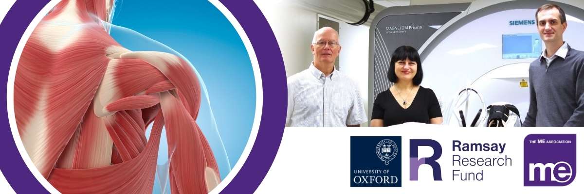 IMAGE DESCRIPTION: Photo of Karl Morten and team, alongside a graphic of the bodies muscles. Logos: ME Association, Ramsay Research Fund, University of Oxford.