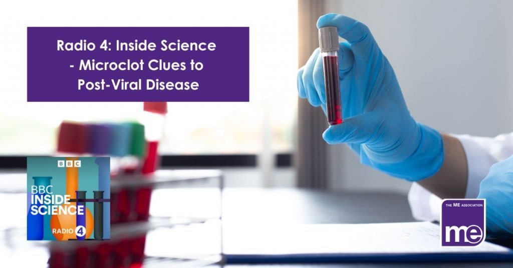 IMAGE DESCRIPTION: A photo of a person with blue gloves on holding a tube of blood. The title of the blog (top left), the BBC Radio 4 Inside Science logo (bottom left) and the ME Association logo (bottom right).