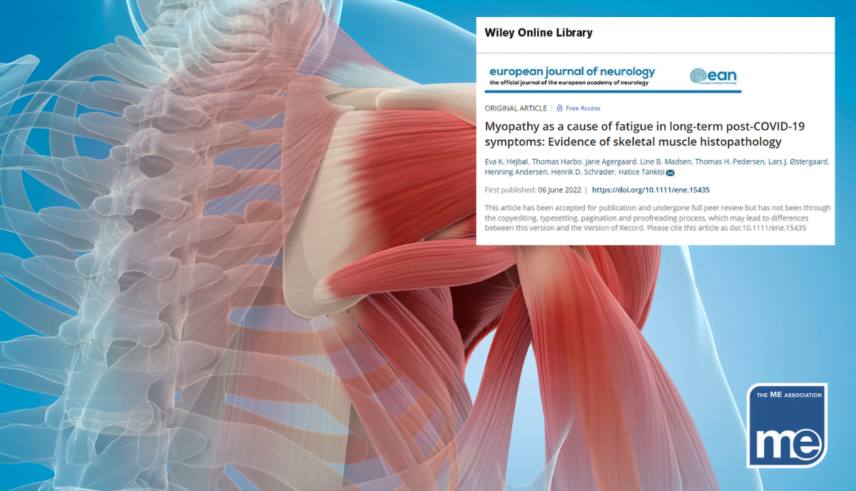 New Research On Muscle Abnormalities In Long Covid - The ME Association