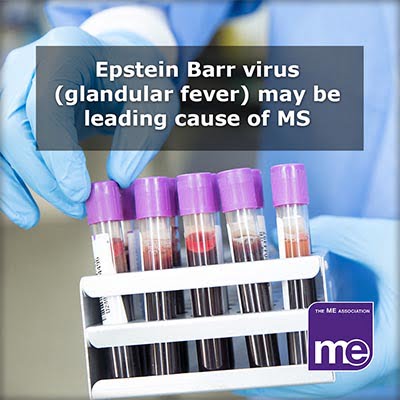 Is Epstein Barr Virus the Leading Cause of Multiple Sclerosis? | The ME ...