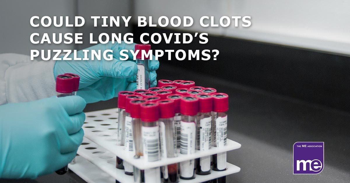 Can tiny blood clots cause Long COVID